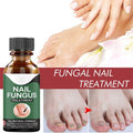Fast Nail Fungal Treatment Serum